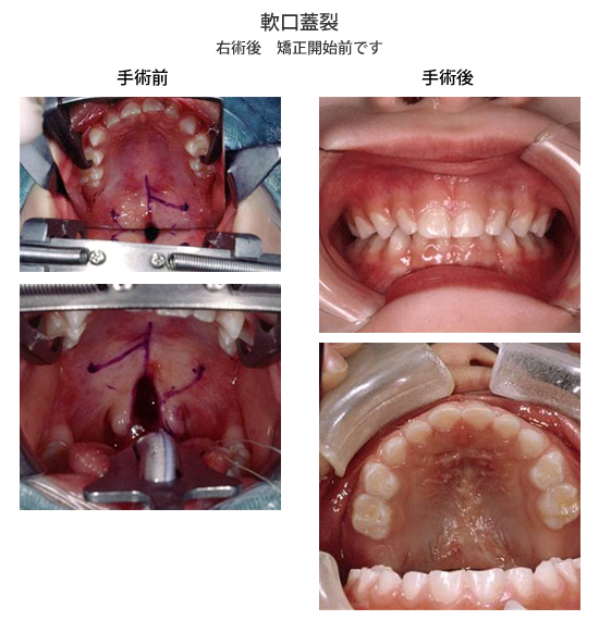 10月, 2016 - Denticola｜歯科医師国家試験のポイント