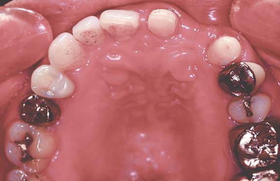 有床 - Denticola｜歯科医師国家試験のポイント